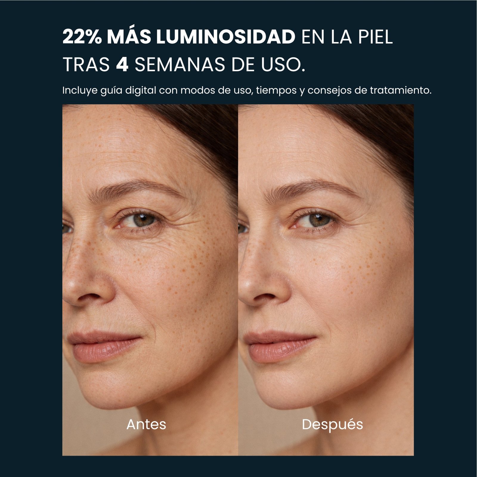 máscara de luz roja – redinn mask 6